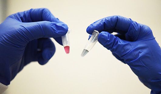 澳洲專家研發血液檢測新篩檢法