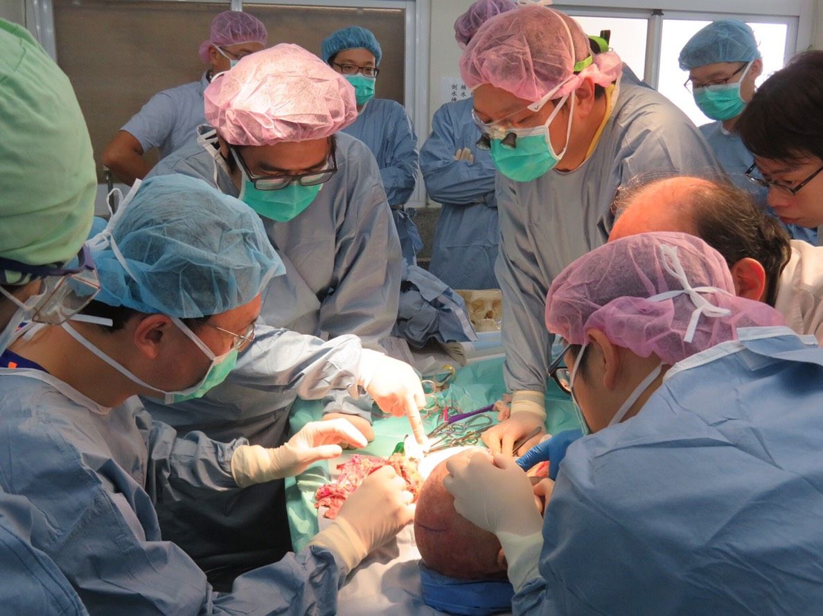 台灣首間醫院獲准替病人「變臉」