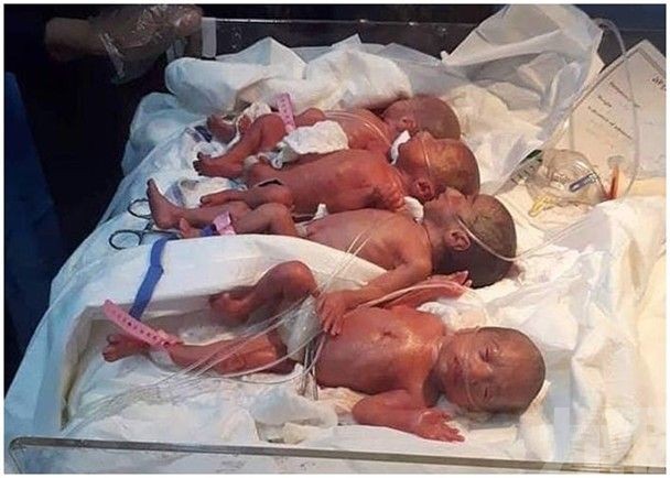 伊拉克女子自然分娩7胞胎