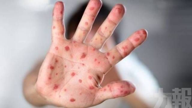 11月大男嬰遊瑞士返澳後染麻疹