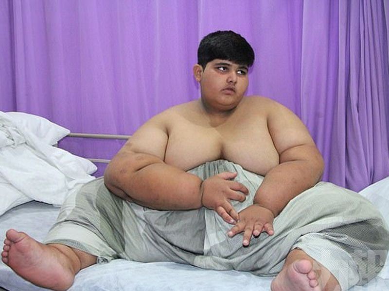 巴基斯坦10歲男孩重達197公斤