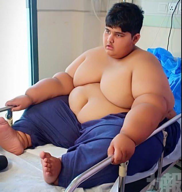 巴基斯坦10歲男孩重達197公斤