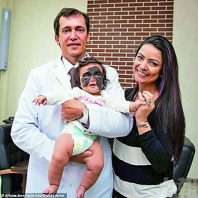 美女嬰赴俄完成首次手術