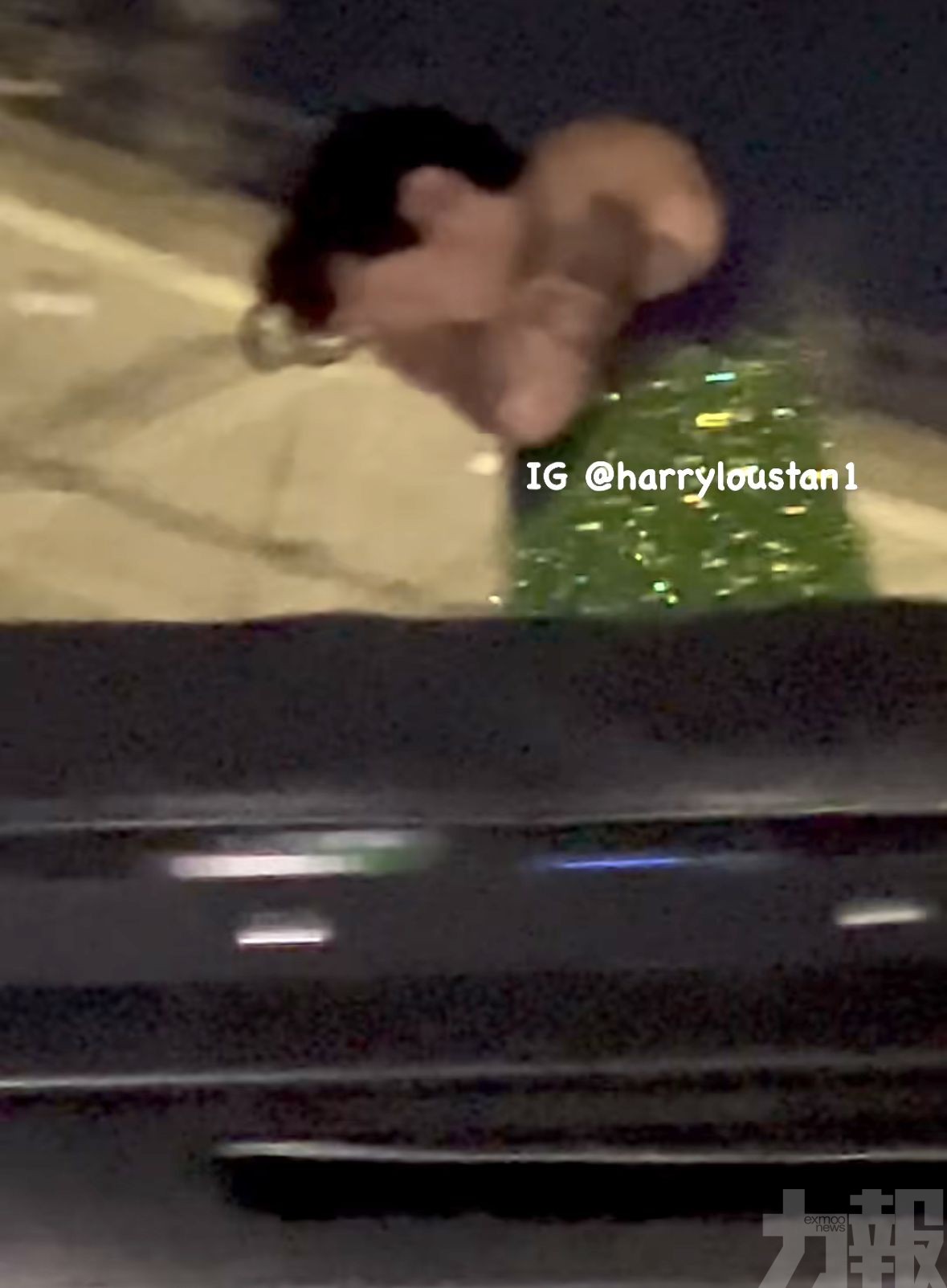 Harry Styles左眼中招掩面