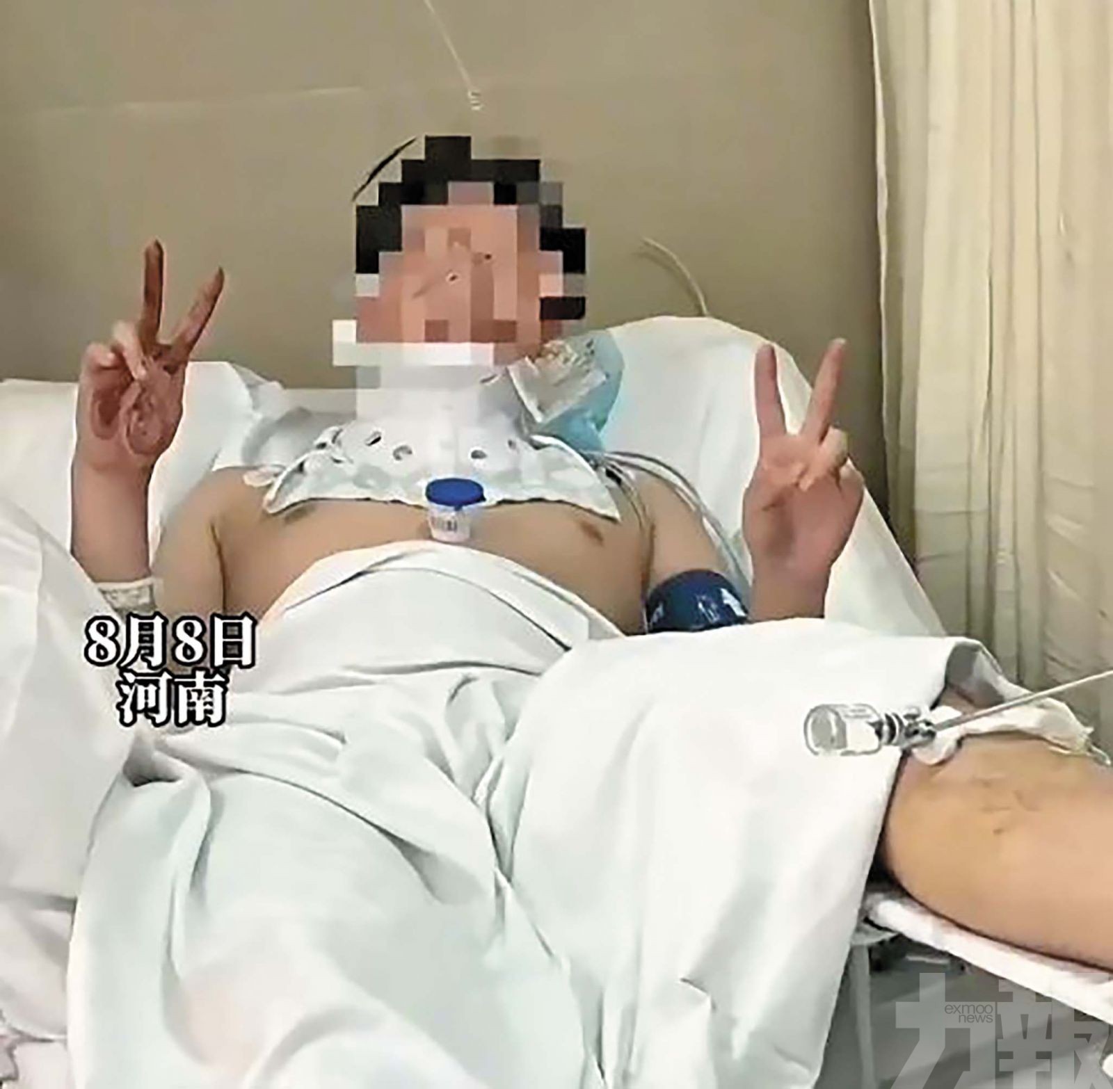 河南小伙三樓墮下多處骨折