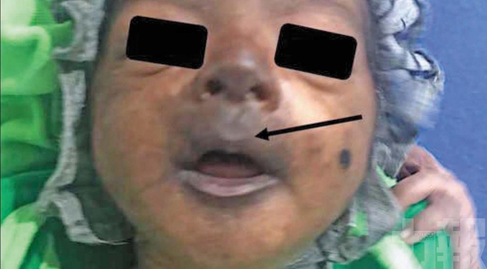 專家警告蚊子已現抗藥性