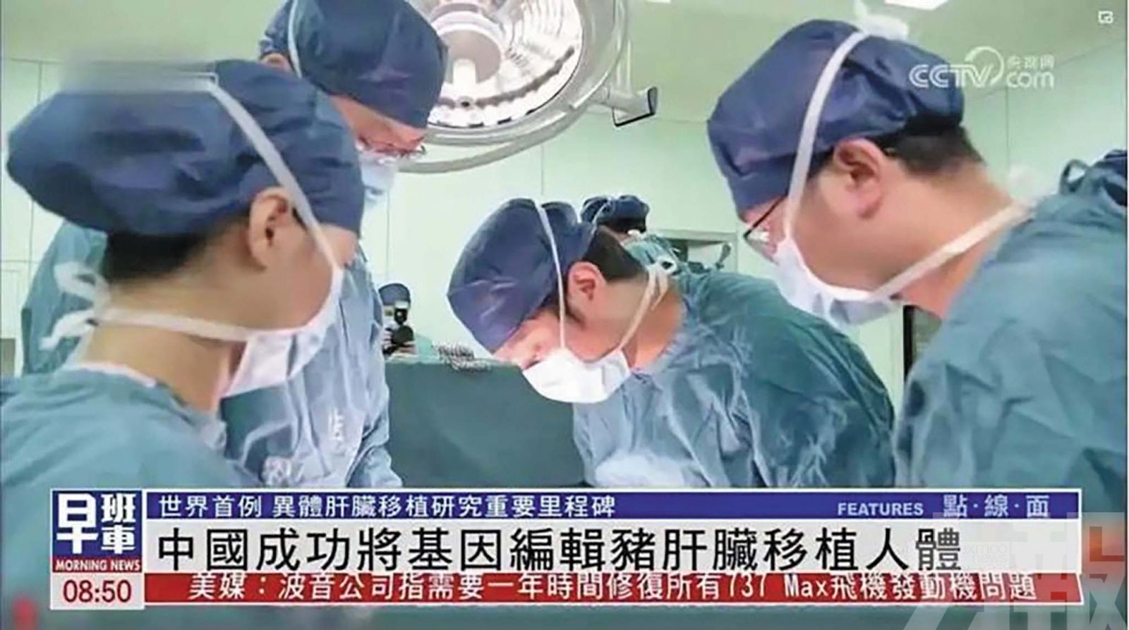 基因編輯豬肺成功移植腦死人體