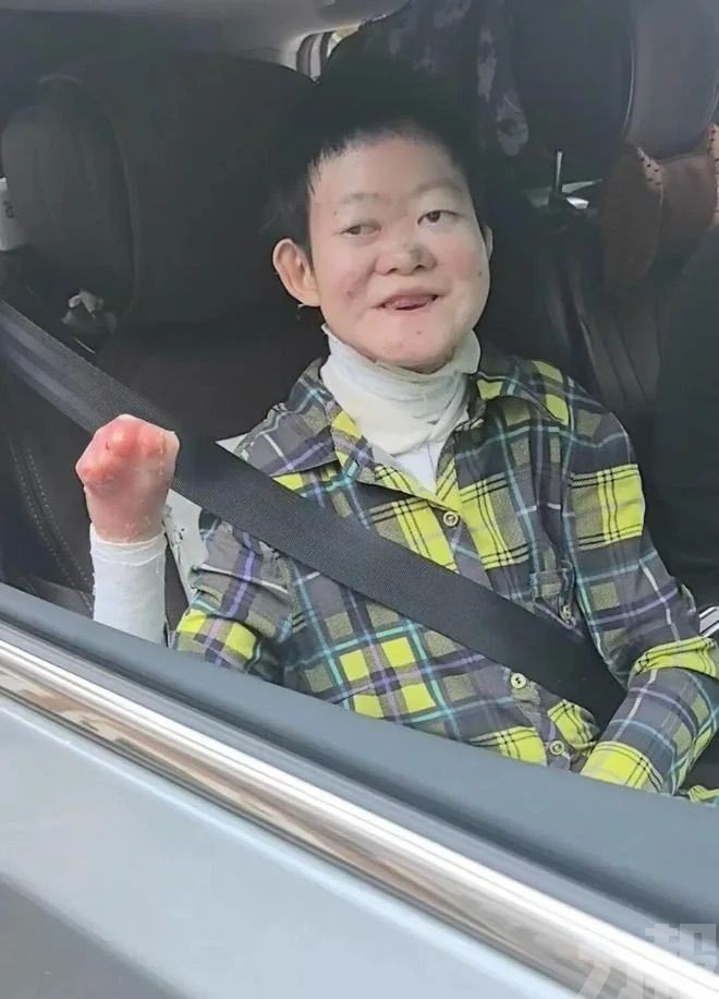 24歲罕病女壯遊西藏