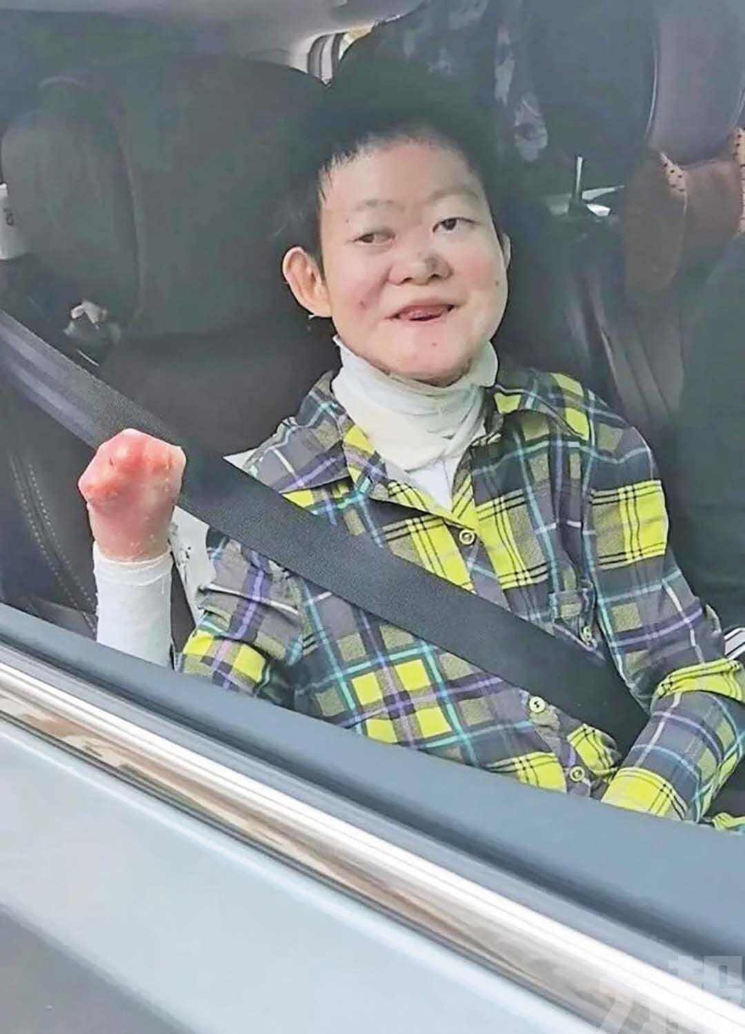 24歲罕病女壯遊西藏