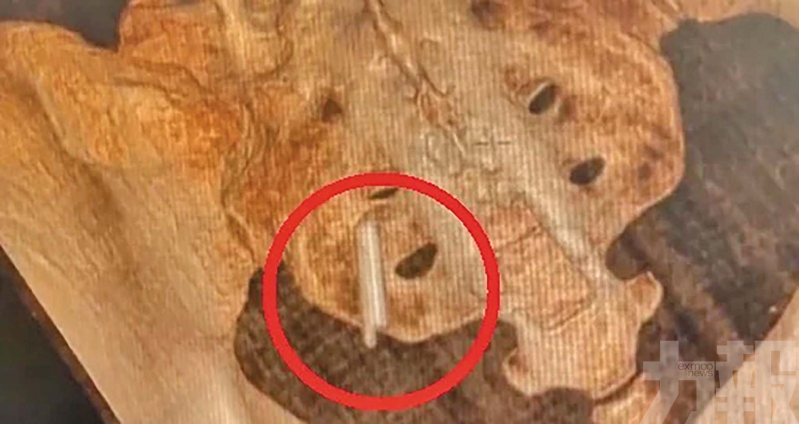 竟是22年前小學同桌惹的禍