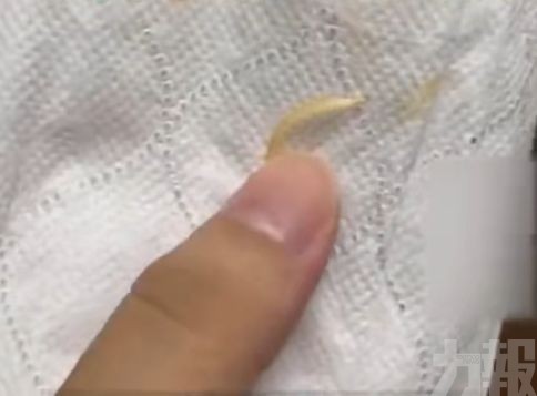 消費者投訴吃出腳指甲與煙頭