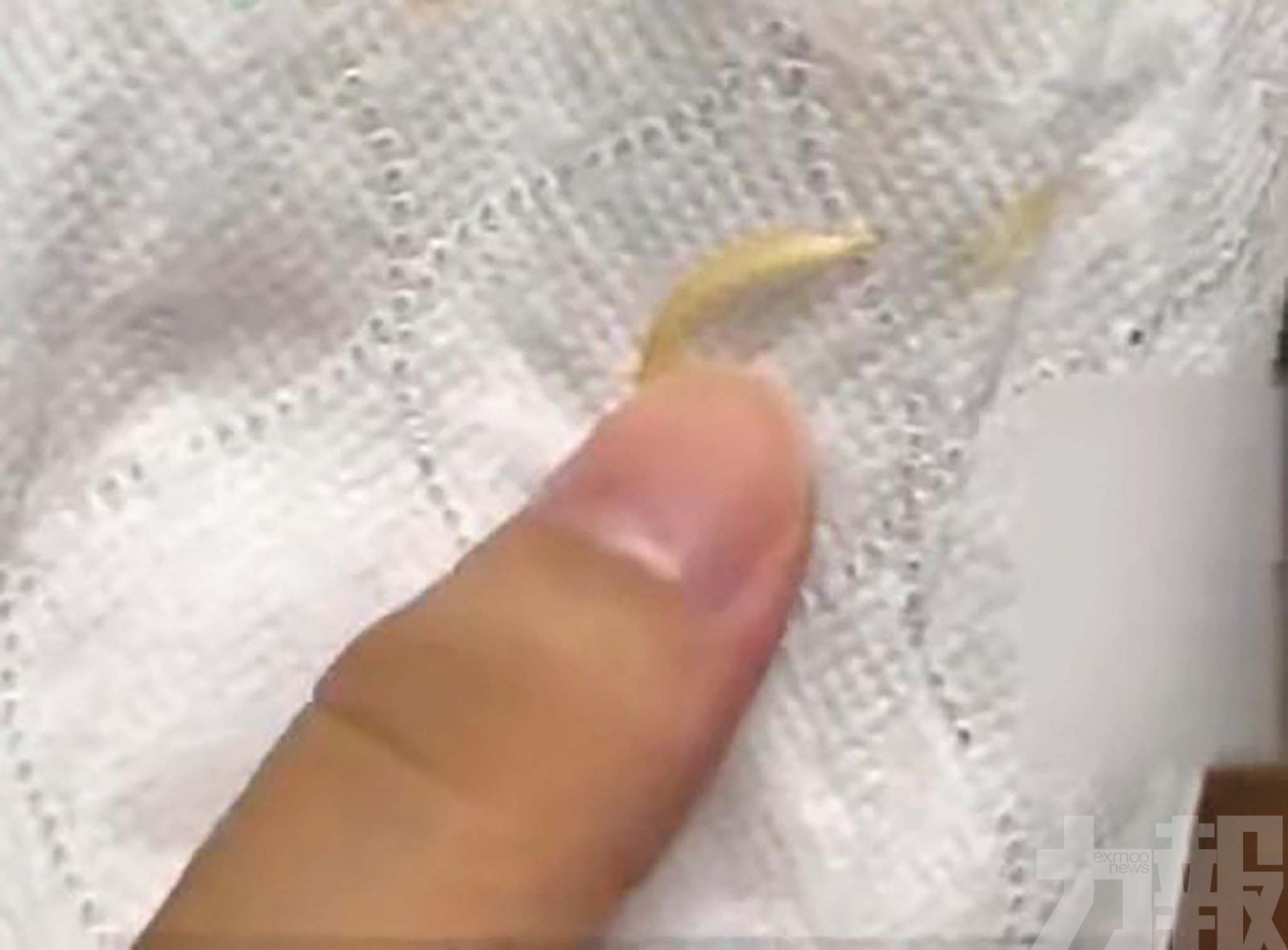 消費者投訴吃出腳指甲與煙頭