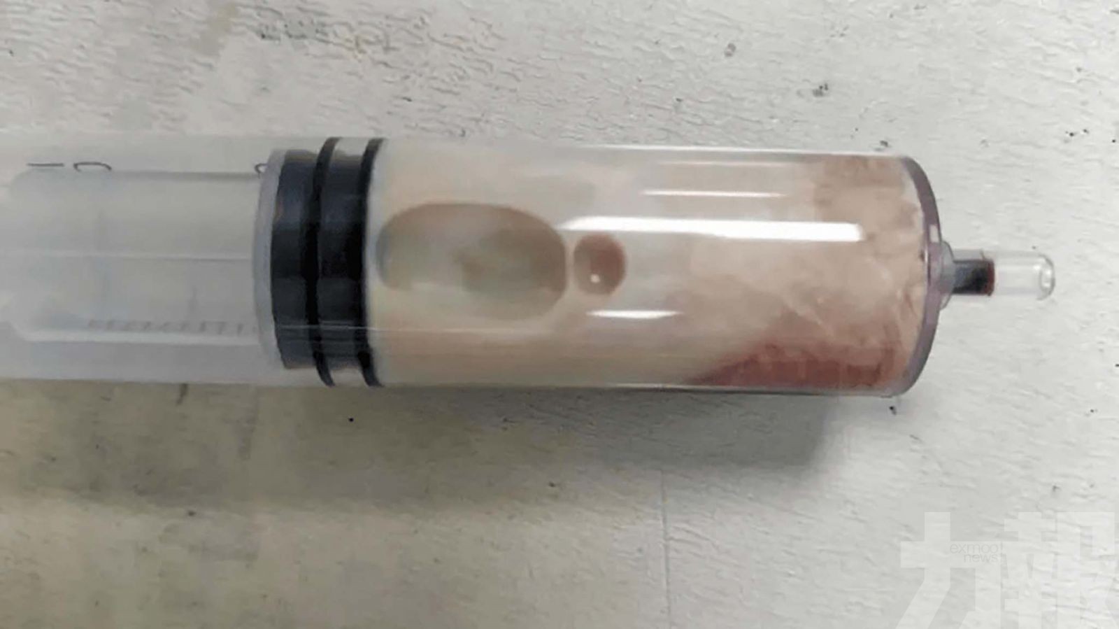 醫生從體內抽出「牛奶血」