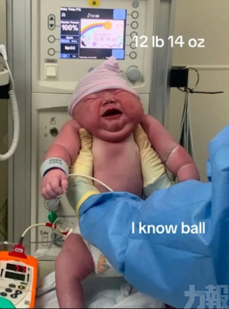 網民：他在肚子裡住了幾年？