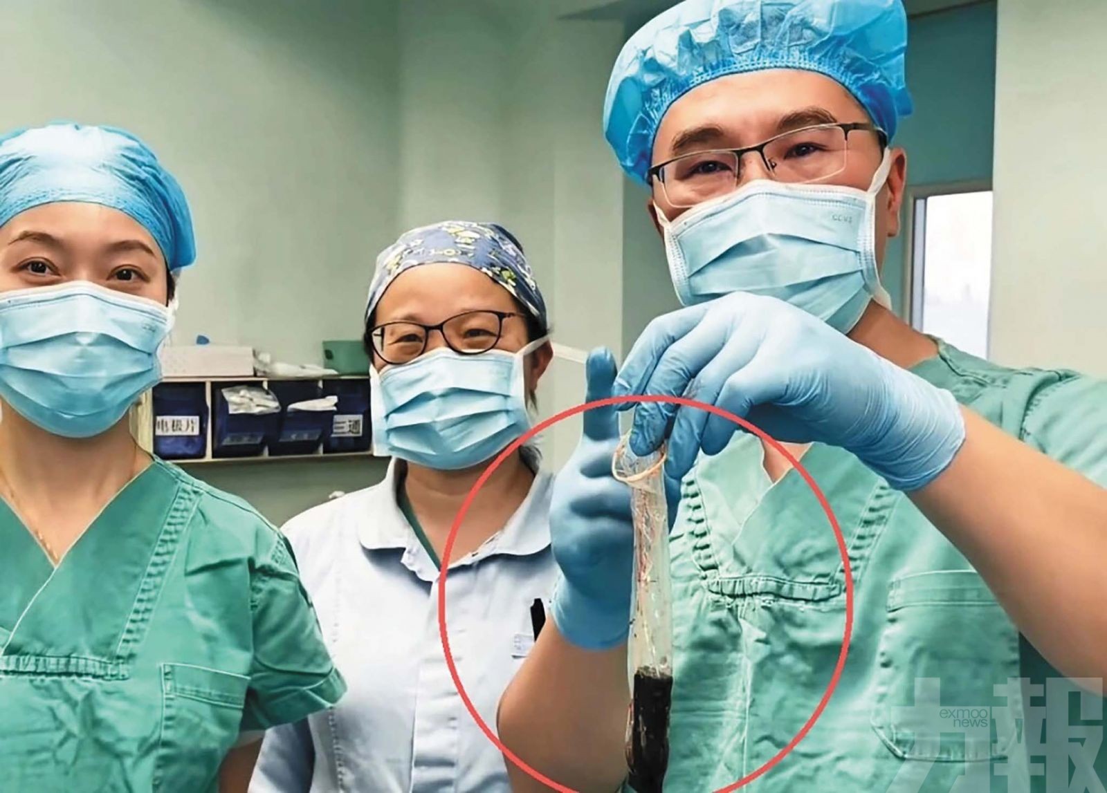 醫生巧用安全套成功取出