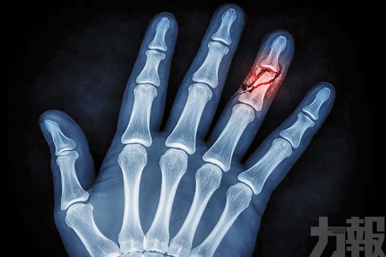 五人詐領32萬元判囚