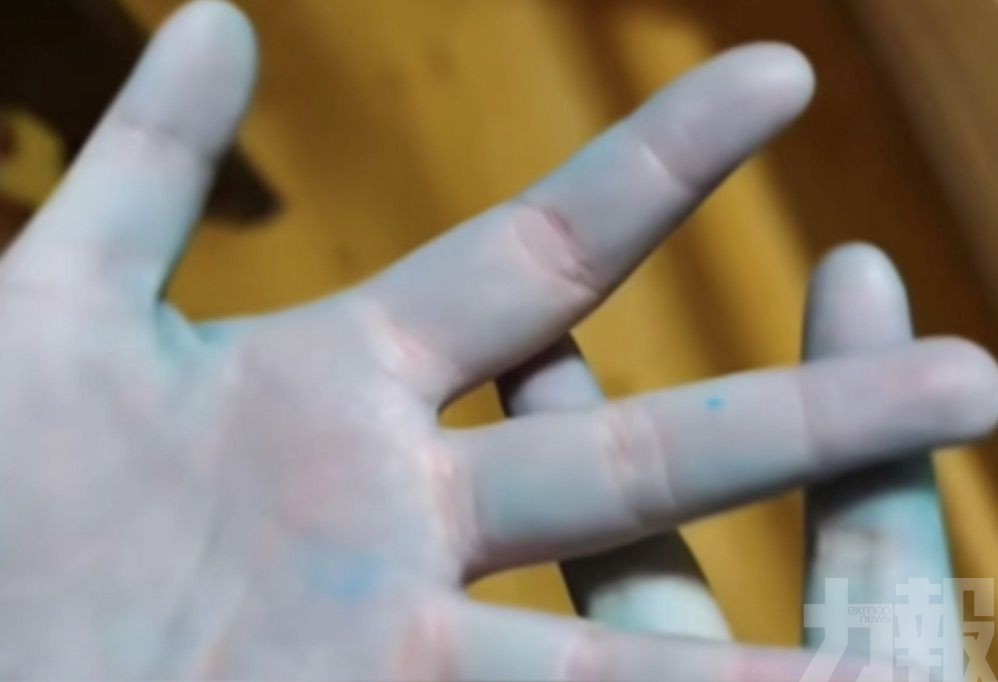 網民食用自製「牛癟火鍋」雙手變藍