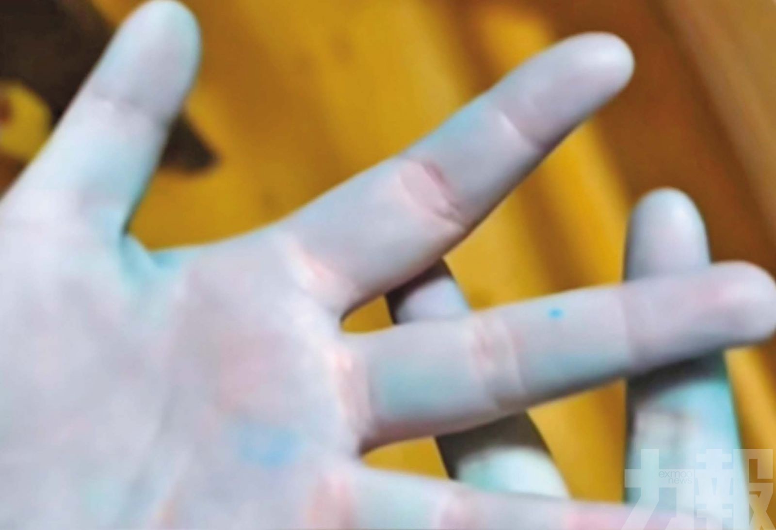 網民食用自製「牛癟火鍋」雙手變藍