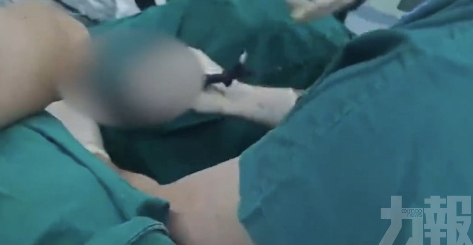 下體潰爛發臭求醫