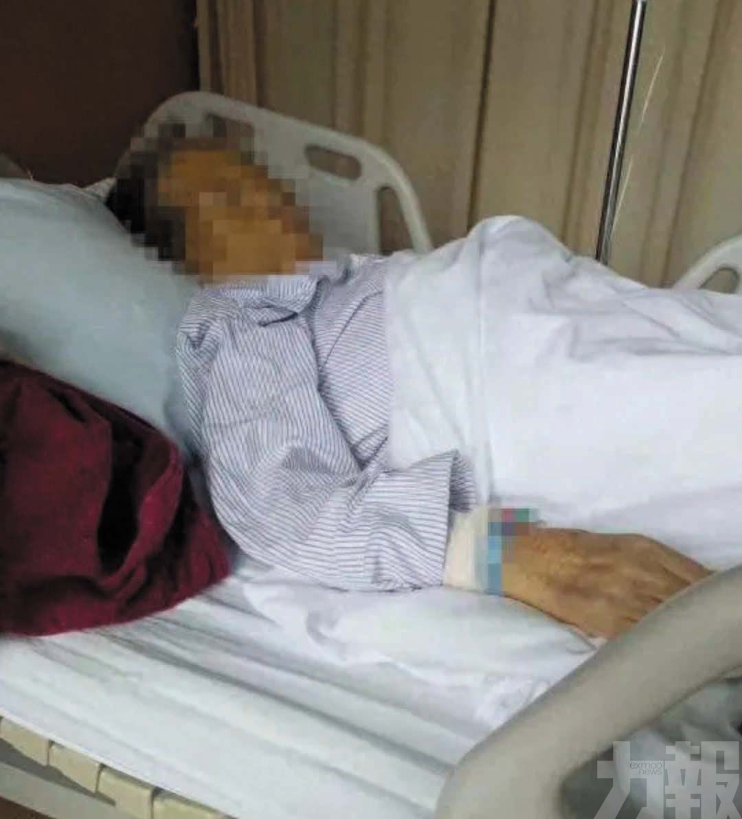 患者腫瘤未清除兩年後離世