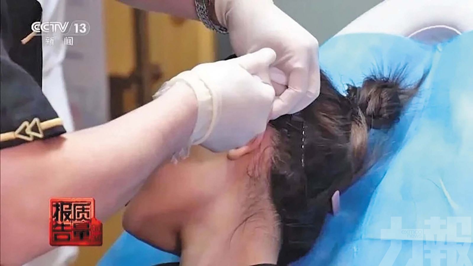 央視揭醫美潮流暗藏致殘隱憂