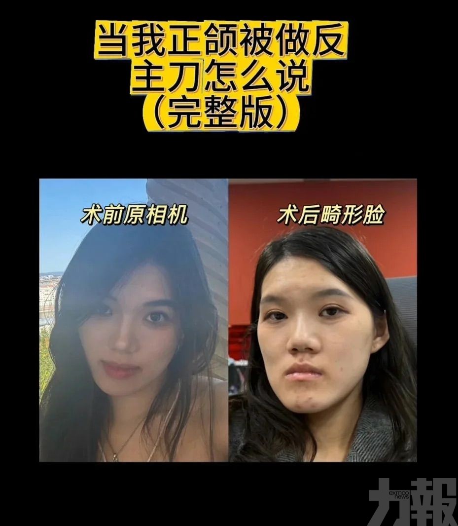 醫生反稱「臉型更洋氣」