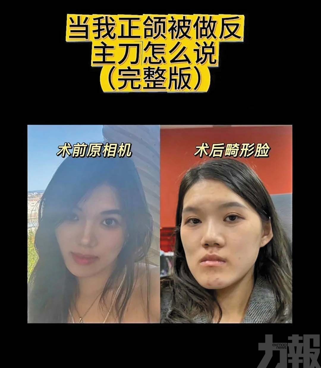 醫生反稱「臉型更洋氣」