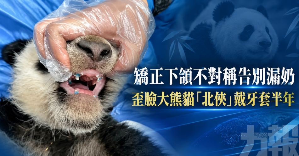 矯正下頜不對稱告別漏奶