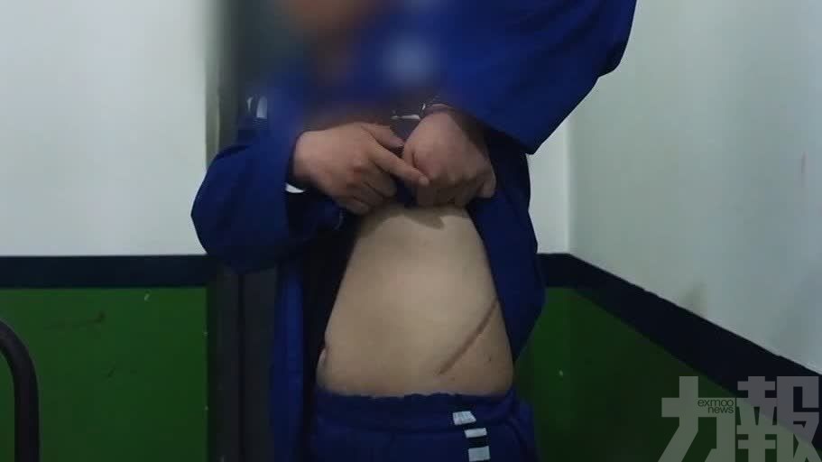 男子自述遭割腎抵債