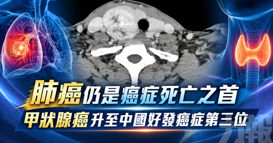 肺癌仍是癌症死亡之首