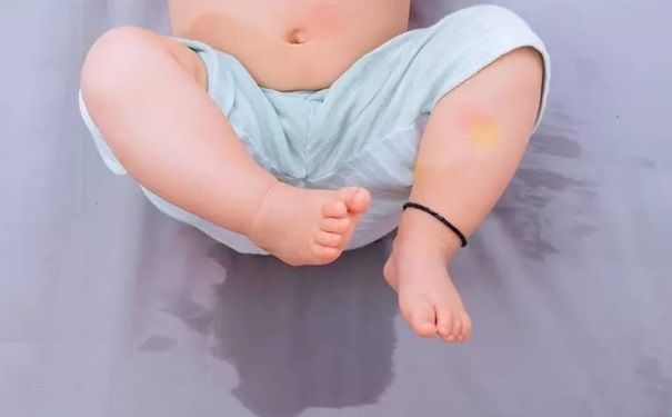 ​丹麥研究：兒童尿床或與遺傳有關