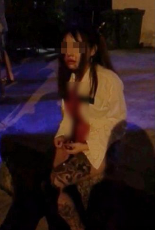 大馬華裔女遇劫 利刀直插入臉
