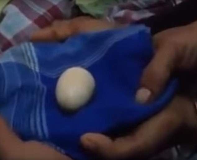 印尼男童兩年誕下20隻蛋