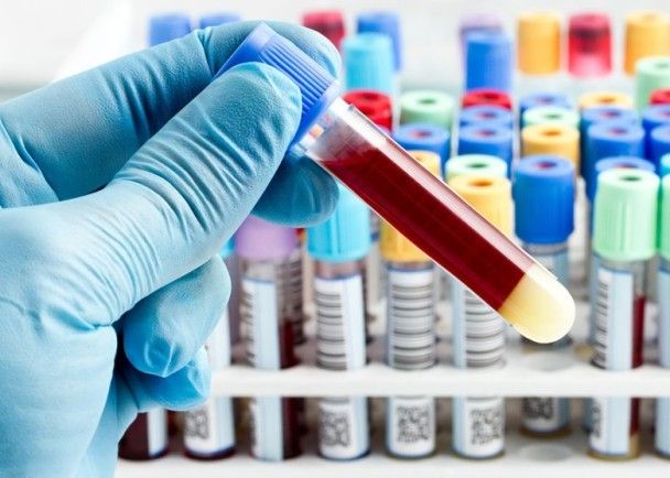 美驗血新法可篩查10類癌症