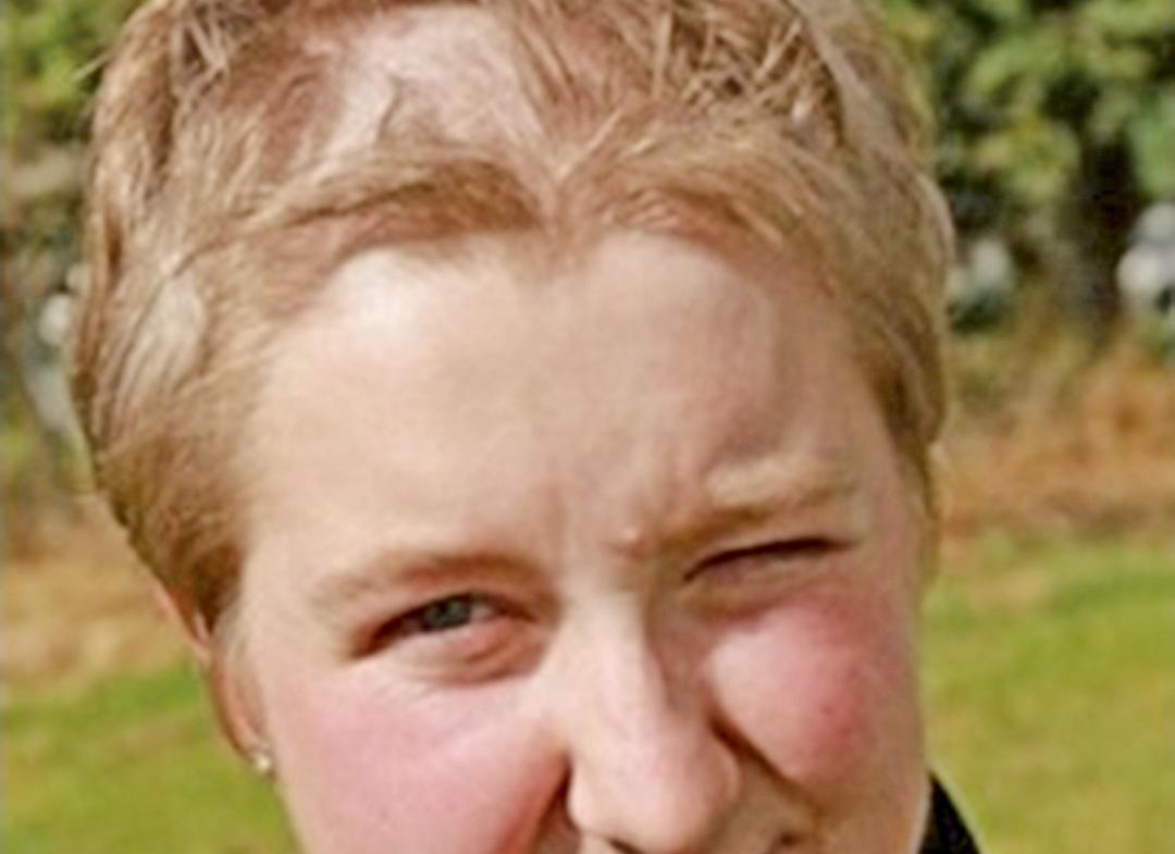 英女變成「鬼剃頭」