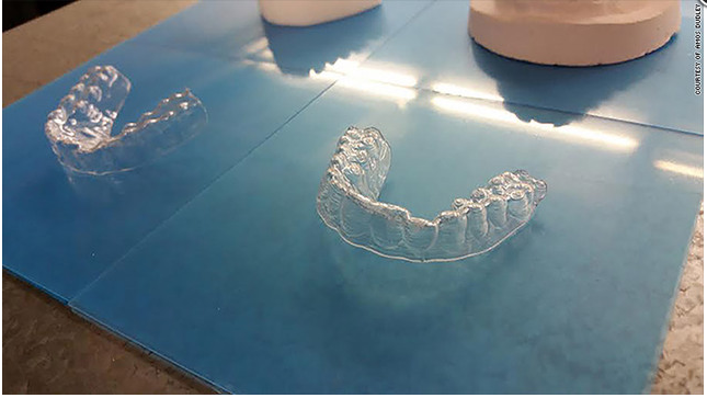 美漢3D打印隱形牙套478蚊搞掂
