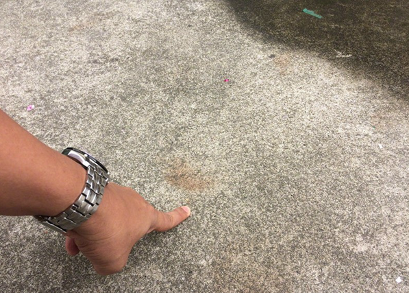 伴娘疑遭推撞失足墮樓