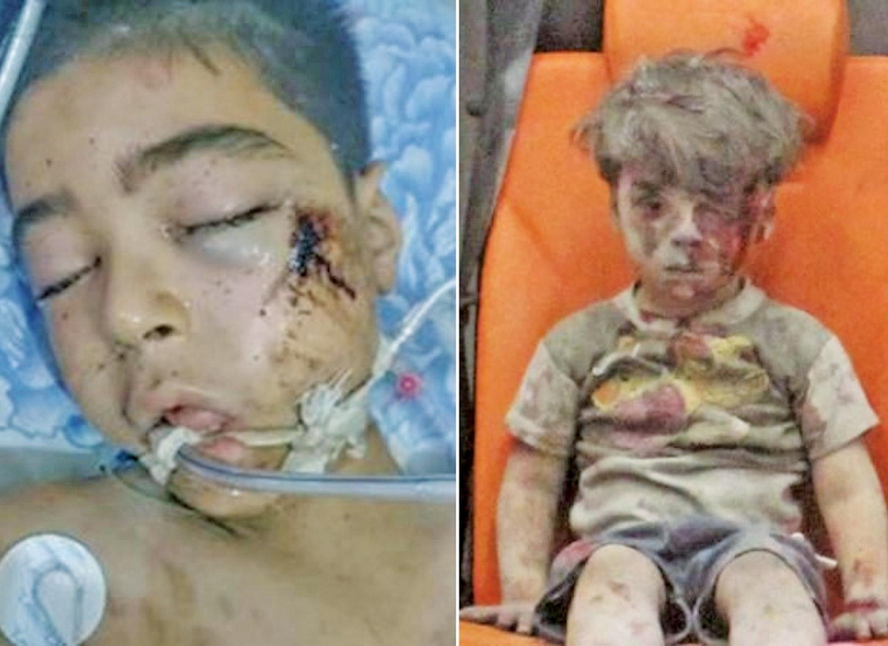 哥哥搶救無效身亡