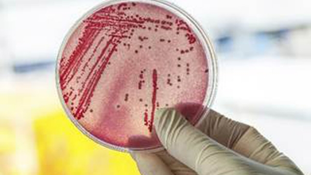 美爆罕見細菌感染釀18死