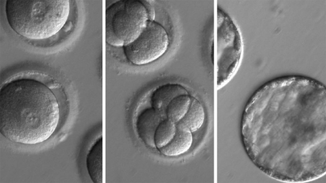 美韓科學家「治癒」胚胎遺傳病