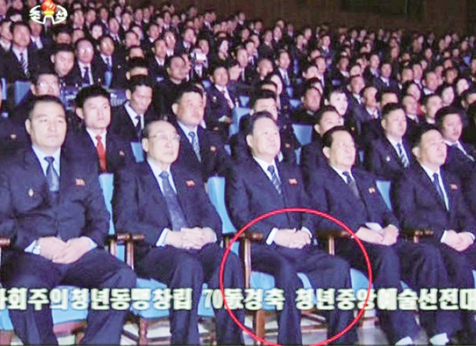 崔龍海露面右腿極細