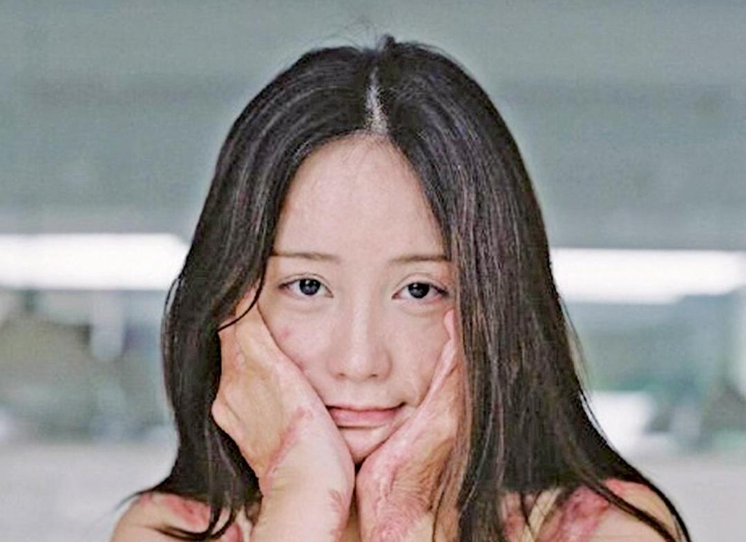 少女拍寫真展傷疤