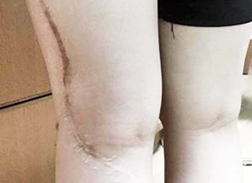 衛生局：已安排手術待病人回覆