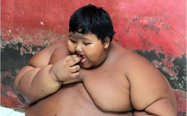 世界第一肥童 十歲重192公斤
