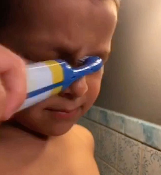 五歲男童用牙膏牙刷洗眼