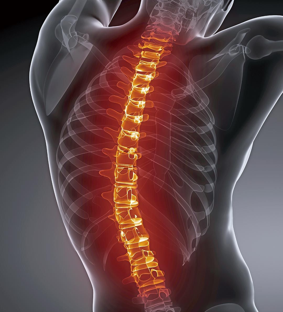 治療脊椎側彎 勿錯過檢查黃金期