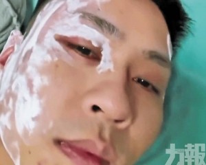 嚴重過敏險毀容