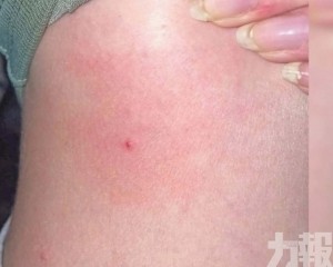 145人報稱被刺傷