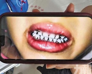 數十名學童鉛濃度超標