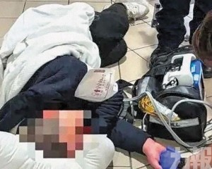 顱骨骨折搶救30小時脫險